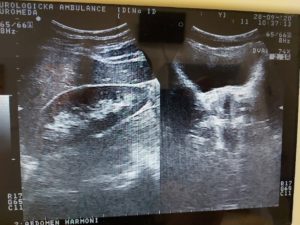 ultrazvuk-uro